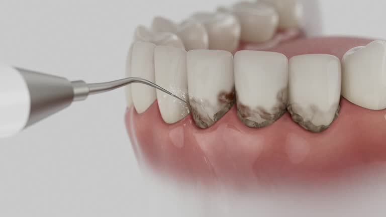 Trusted Tooth Extraction service in Long Beach, CA - Dentist Open Now